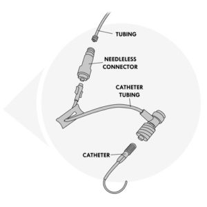 309.1eSeparate parts of the venous access device