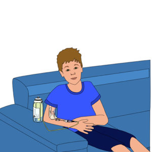 331.Child seated with elastomeric infusion pump with reservoir full