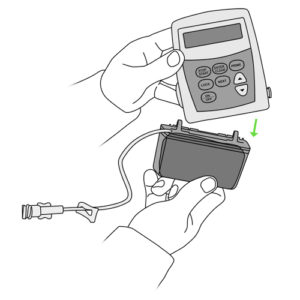350e.Hands disconnecting cassette reservoir of the pump