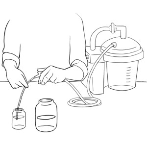 Tracheostomy rinse suction catheter